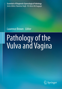 Laurence Brown (editor) Pathology of the Vulva and Vagina