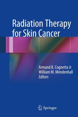 Jr. Cognetta - Radiation Therapy for Skin Cancer