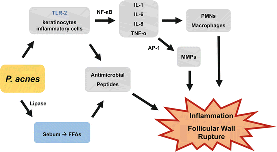 Fig 11 P acnes promotes acne pathogenesis through multiple pathways - photo 1