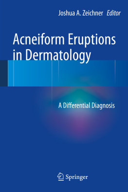 Joshua A. Zeichner (editor) - Acneiform Eruptions in Dermatology: A Differential Diagnosis