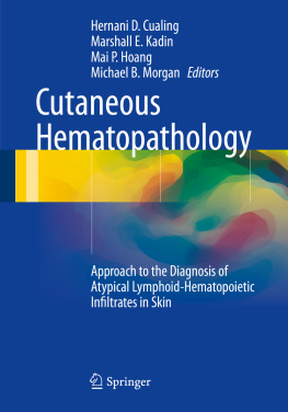 Hernani D. Cualing Cutaneous Hematopathology: Approach to the Diagnosis of Atypical Lymphoid-Hematopoietic Infiltrates in Skin