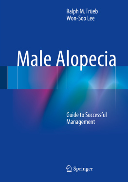 Ralph M. Trüeb - Male Alopecia: Guide to Successful Management