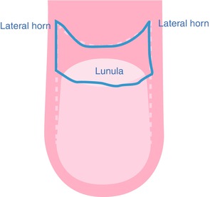 Fig 13 Drawing of the matrix in frontal view it has a horseshoe shape with - photo 3