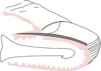 Fig 14 Transverse section of the nail showing the different epithelia The - photo 4