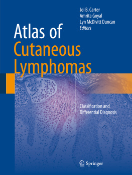 Joi B. Carter Atlas of Cutaneous Lymphomas: Classification and Differential Diagnosis