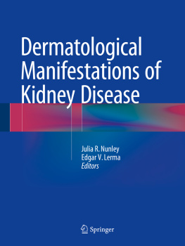 Julia R. Nunley Dermatological Manifestations of Kidney Disease
