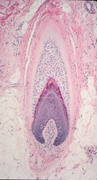 Fig 15 The dermal papilla surrounded by the hair matrix The Matrix - photo 5