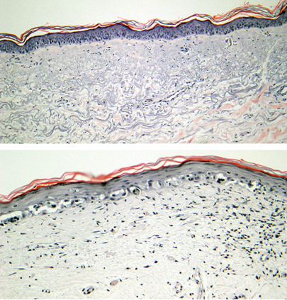 Fig 11 Bottom panel reveals almost continuous single melanocyte - photo 1