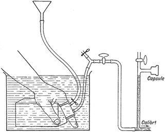 Fig 12 The local fault theory experiment 1929 The finger of the patient - photo 2