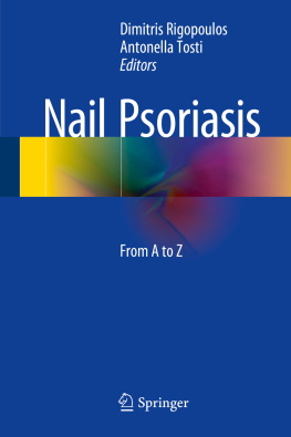 Dimitris Rigopoulos - Nail Psoriasis: From A to Z