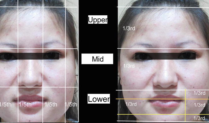 Fig 11 Dimensions of the ideal face divided into horizontal facial thirds and - photo 1