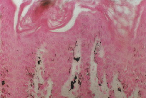 Fig 12 Silver-stained melanocytes The dendritic processes of melanocytes - photo 2