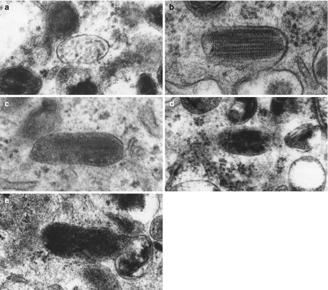 Fig 13 Ultrastructure of eumelanosomes The four stages of eumelanosome - photo 3