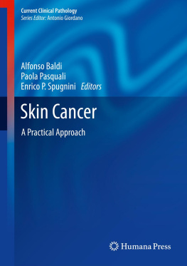 Alfonso Baldi Skin Cancer: A Practical Approach