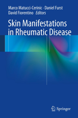 Marco Matucci-Cerinic - Skin Manifestations in Rheumatic Disease