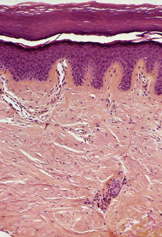 Fig 12 Histological pattern of the skin of the dorsum of the hand see text - photo 2