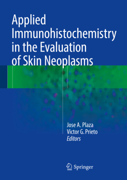 Jose A. Plaza - Applied Immunohistochemistry in the Evaluation of Skin Neoplasms