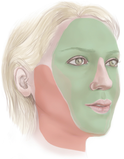 Fig 11 Face and neck rejuvenation techniques need to correct sagging in the - photo 1