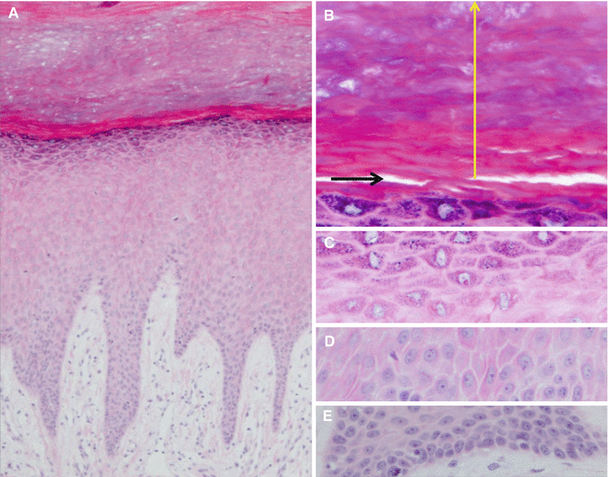 Fig 13 Epidermis of the plantar skin In comparison with the thigh skin Fig - photo 3