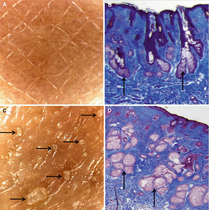 Fig 15 Differences can be observed in the development of the sebaceous glands - photo 5