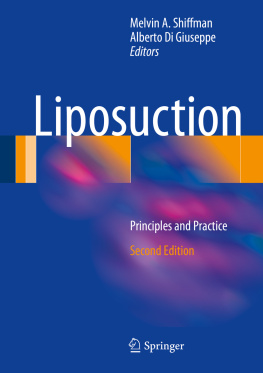 Melvin A. Shiffman - Liposuction: Principles and Practice