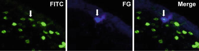 Fig 12 Example of double-labeled neuron Left panel shows Fos-immunoreactive - photo 2