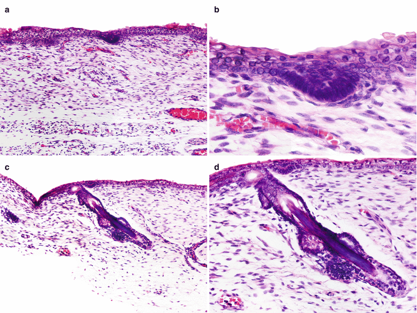 Fig 11 Embryonic development of folliculo-sebaceous-apocrine unit a - photo 1