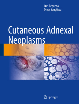 Luis Requena Cutaneous Adnexal Neoplasms