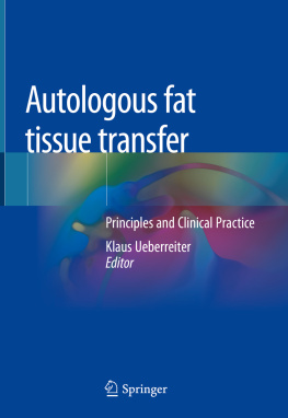 Klaus Ueberreiter (editor) - Autologous fat tissue transfer: Principles and Clinical Practice