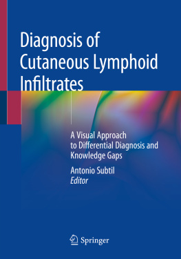 Antonio Subtil - Diagnosis of Cutaneous Lymphoid Infiltrates: A Visual Approach to Differential Diagnosis and Knowledge Gaps