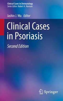 Jashin J. Wu Clinical Cases in Psoriasis