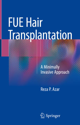 Reza P. Azar FUE Hair Transplantation: A Minimally Invasive Approach