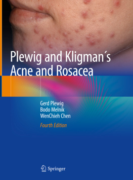 Gerd Plewig - Plewig and Kligman’s Acne and Rosacea