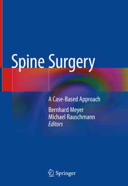 Bernhard Meyer - Spine Surgery