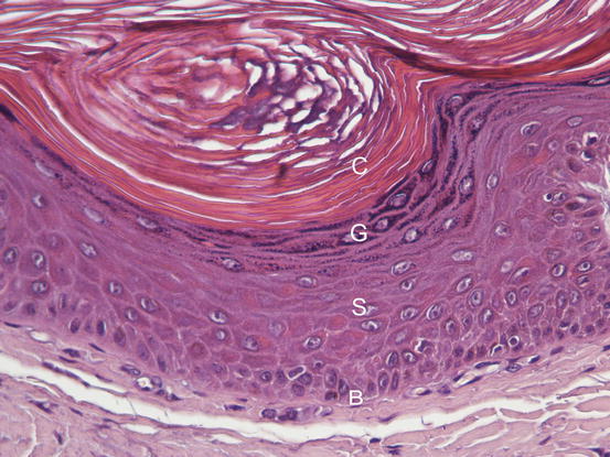 Fig 11 Histology of the epidermis hyperplastic epidermis in which the - photo 1