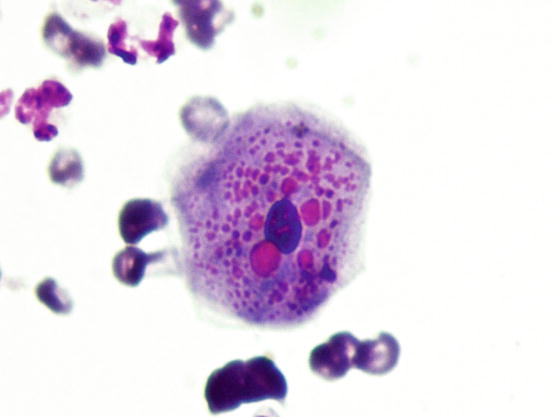 Fig 14 Cytology of the stratum granulosum large polygonal keratinocytes with - photo 4