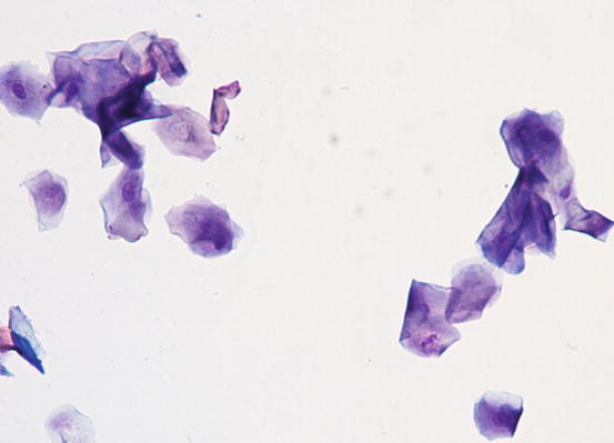 Fig 15 Cytology of the stratum corneum many anucleate keratinocytes - photo 5