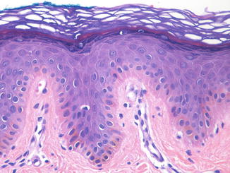 Fig 2 Epidermis The epidermis is a stratified keratinized epithelium The - photo 2