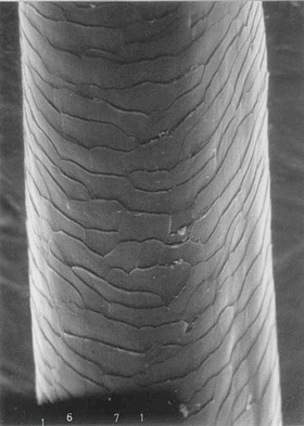 Fig 12 Electron micrograph showing the overlapping scale-like cells of the - photo 2