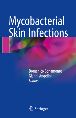 Domenico Bonamonte and Gianni Angelini - Mycobacterial Skin Infections