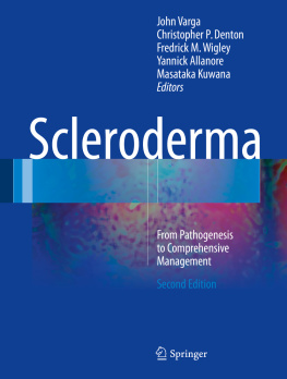 John Varga - Scleroderma: From Pathogenesis to Comprehensive Management