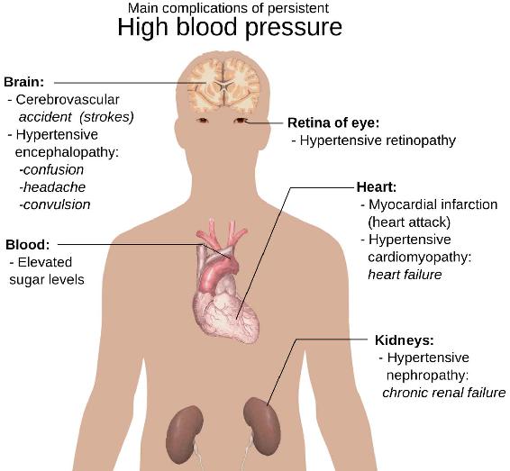 Angina Having chest pain is quite a common symptom of high blood pressure - photo 2