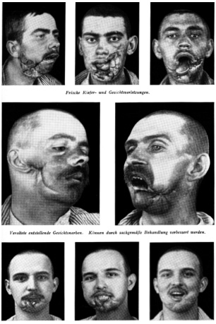 These photographs were meant to demonstrate the success of plastic surgery - photo 7