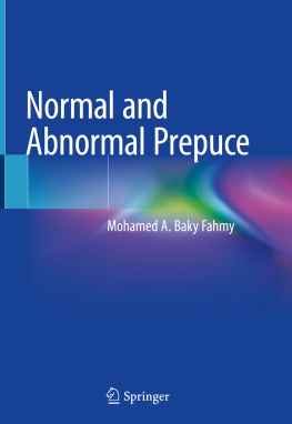 Mohamed A. Baky Fahmy Normal and Abnormal Prepuce