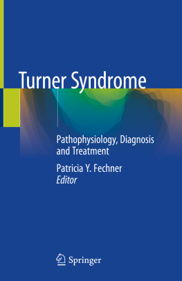 Patricia Y. Fechner Turner Syndrome: Pathophysiology, Diagnosis and Treatment