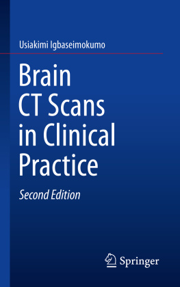 Usiakimi Igbaseimokumo - Brain CT Scans in Clinical Practice