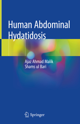Ajaz Ahmad Malik - Human Abdominal Hydatidosis