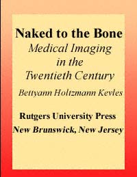title Naked to the Bone Medical Imaging in the Twentieth Century Sloan - photo 1