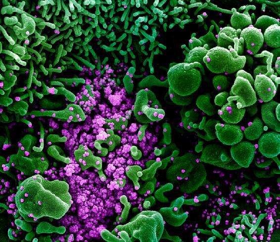 Colorized scanning electron micrograph of an apoptotic cell green heavily - photo 2