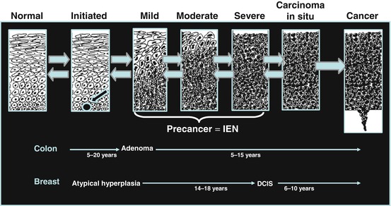 Fig 11 Progression of precancer to cancer in humans is a multiyear process - photo 1